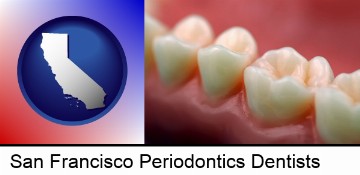 teeth and gums in San Francisco, CA