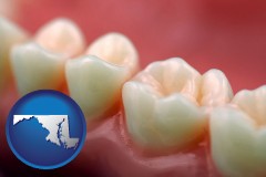 maryland map icon and teeth and gums