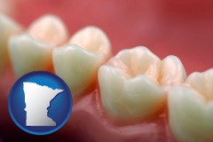 minnesota map icon and teeth and gums