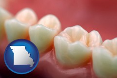 missouri map icon and teeth and gums